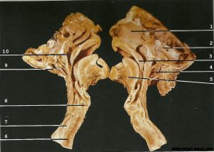 Sectiune sagitala prin cavitatea nazala, bucala, faringe, laringe, trahee si esofag